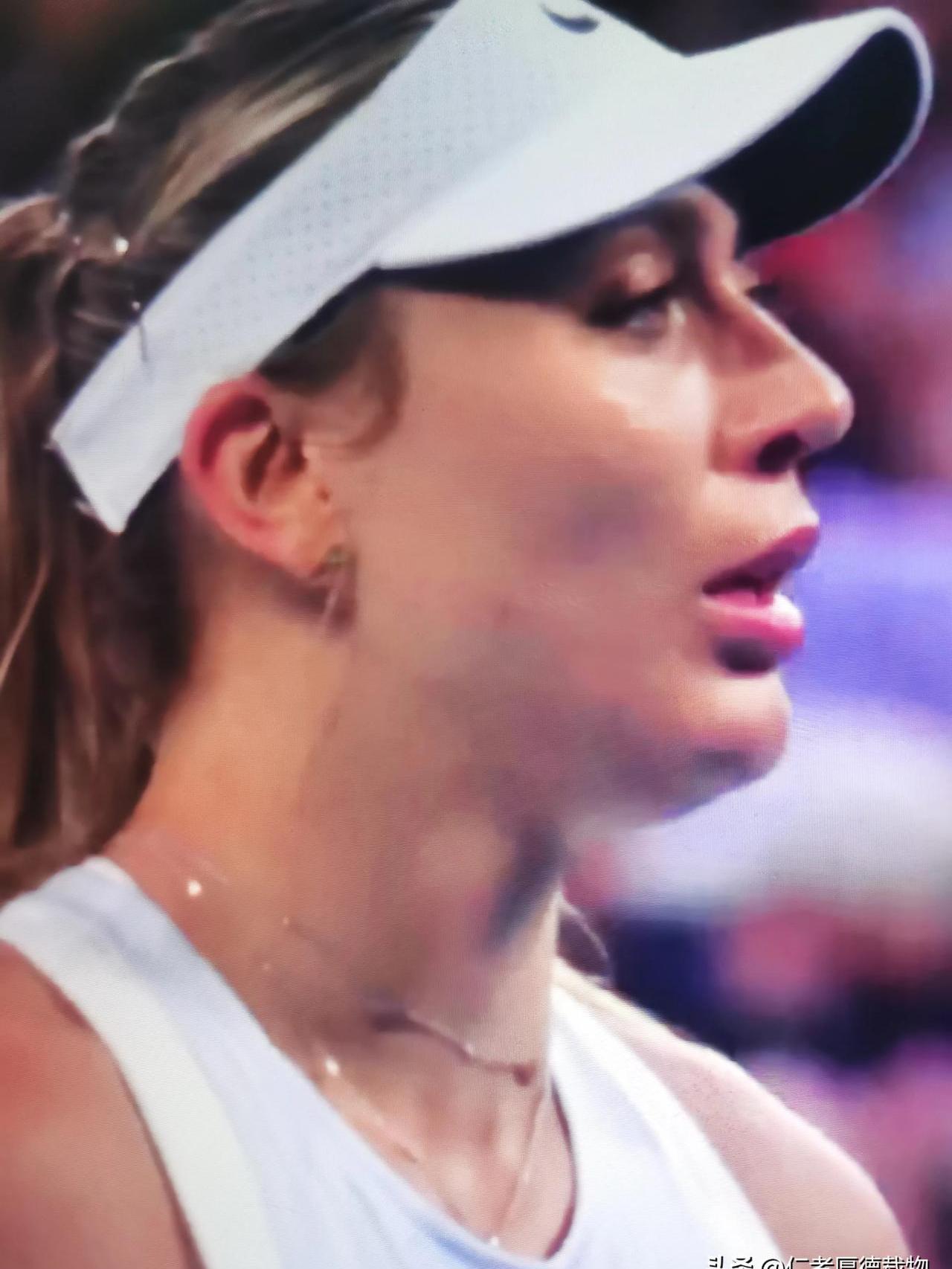 澳大利亚球员受伤，或将缺席季后赛